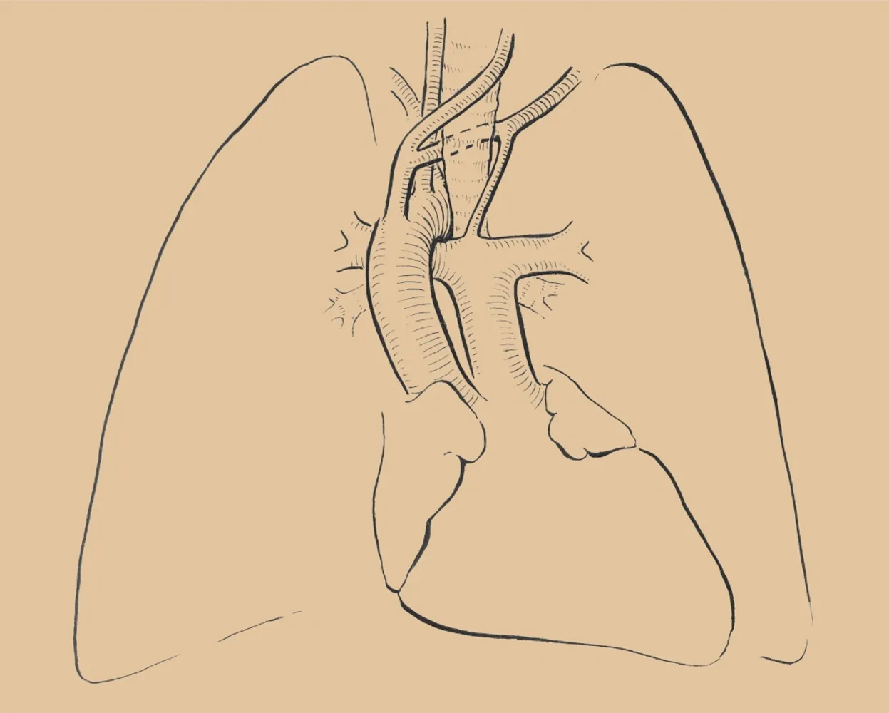 Skitse af lunger og muskulatur, der illustrerer vejrtrækning og støtte for sangere